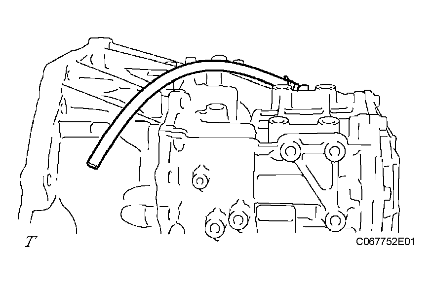 G04154225