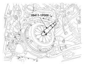 G11795025