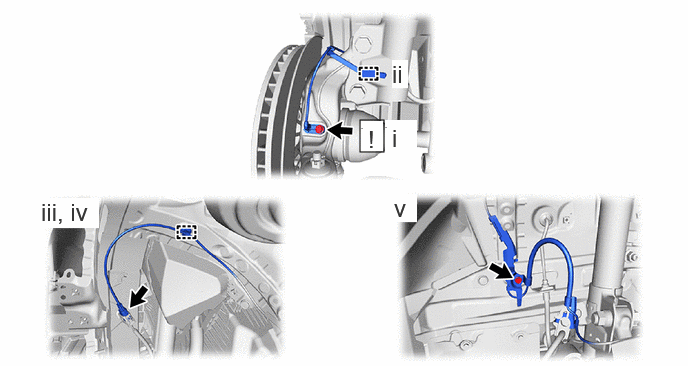 GTY1141557
