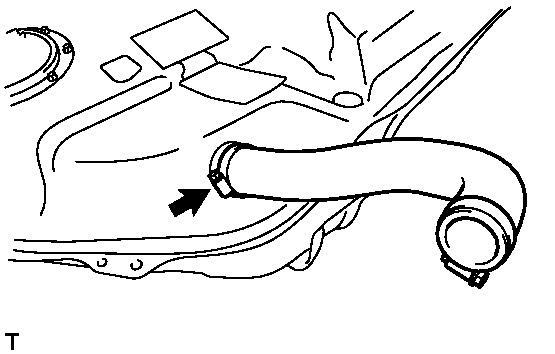 GTY145270